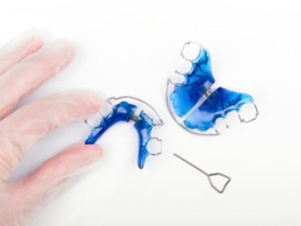 Removable orthodontic appliance